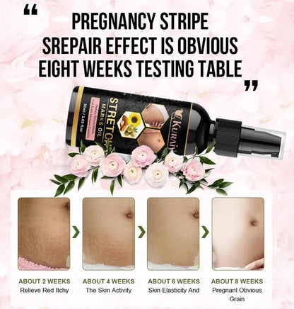 Kuraiy present Repair Stretch Marks Removal - Natural Heal Pregnancy Breast, Hip, Legs, Mark oil 500 ml pack of 1